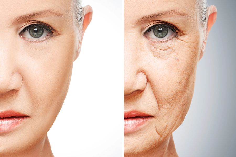 can semaglutide cause eczema Ozempic® Face: What is it and how can you avoid it