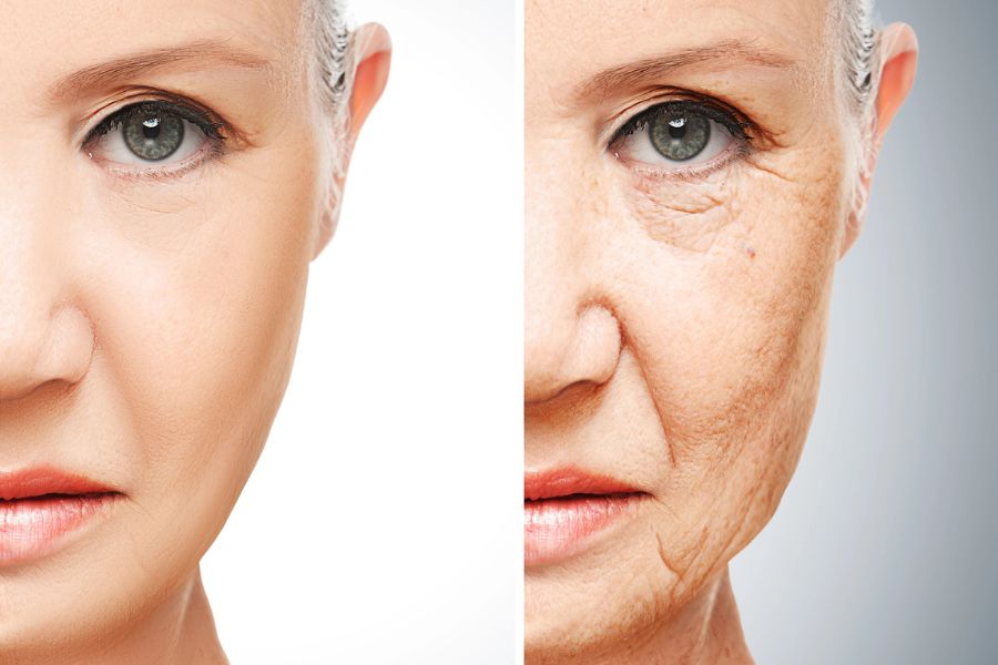 Ozempic® Face: What is it and how can you avoid it